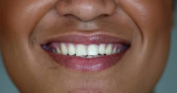 Happy Ras Campuran Wanita Muda Close Mulut Tersenyum — Stok Foto