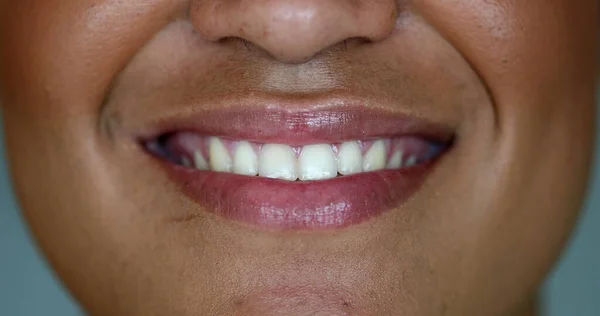 Wanita Hitam Bibir Dan Mulut Macro Close Tersenyum Afrika Amerika — Stok Foto