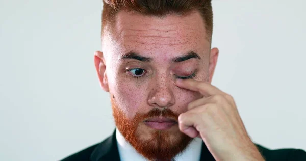 Young man scratching face with hand. Business person touching eye