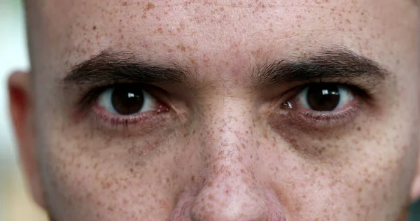 Расстроенный Человек Рычит Крупным Планом Глаза Рот Рыжеволосая Рыжая Борода — стоковое фото