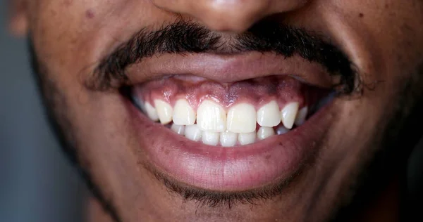 Lips Macro Close Black African Man Smiling —  Fotos de Stock