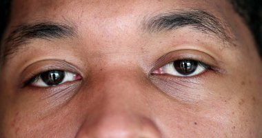 African american macro close-up eyes in SHOCK surprised reaction