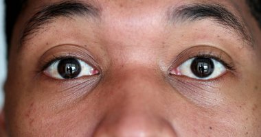 African american macro close-up eyes in SHOCK surprised reaction