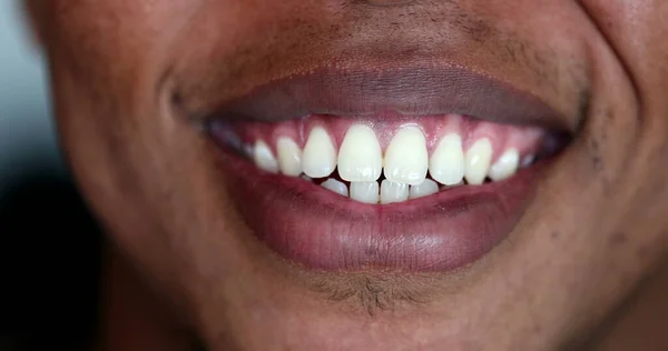 African Person Mouth Smiling Close White Teeth —  Fotos de Stock