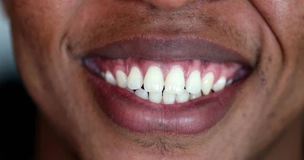African Person Mouth Smiling Close White Teeth — 스톡 사진