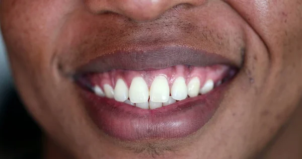 African Man Mouth Close — Stock Fotó
