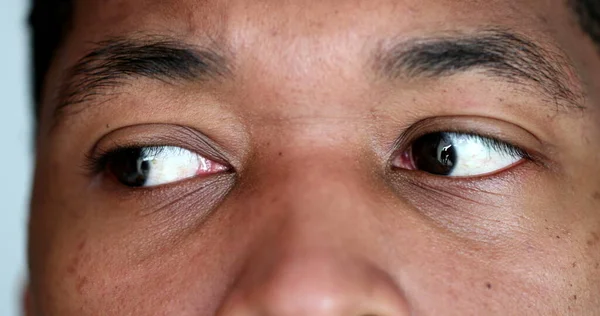 African American Macro Close Eyes Shock Surprised Reaction — Fotografia de Stock