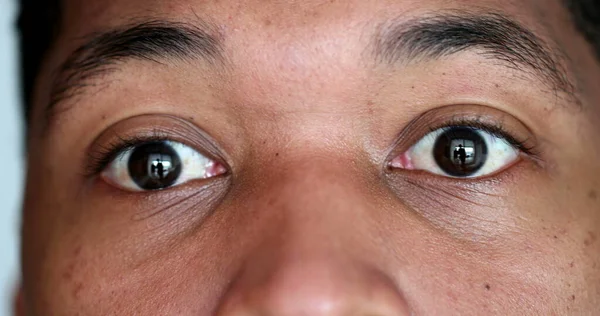 African American Macro Close Eyes Shock Surprised Reaction — Stok Foto