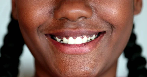 Černoafrické Rty Usmívají Makro Close Dívka Úsměv — Stock fotografie