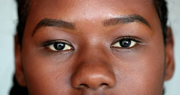 African girl eyes staring camera. Macro close-up Mixed race young woman eye, casual real person