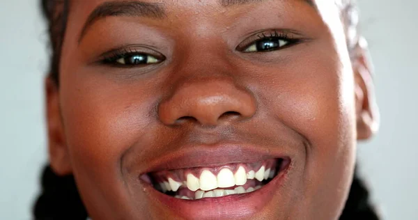 Happy Young Black Woman Smiling Extreme Close Face African Girl — Stock Photo, Image