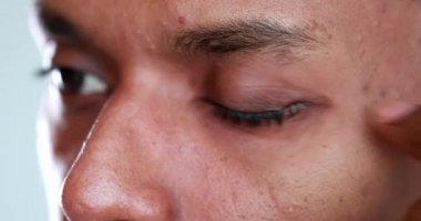 Man touching face rubbbing eye with finger and hand