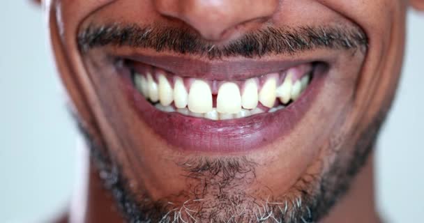 African Man Descent Wide Smile Camera Close Mouth — Stockvideo