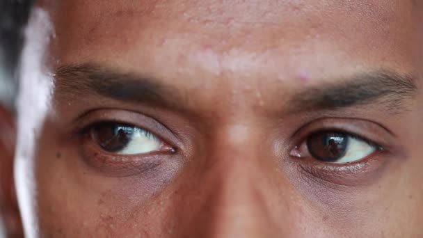 Paranoid Eyes Looking Sideways Feeling Stressed Anxiety Scarred Terror Shock — Stok video