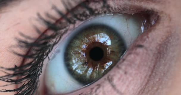 Macro Shot Eyes Being Opened Wide Open Shock Eye Opening — Stockvideo