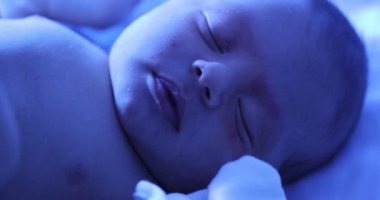 Newborn baby infant, first day of life, under phototherapy lamp