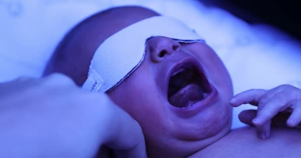 Новорожденный Мальчик Получает Лечение Желтухи Лампой Фототерапии — стоковое видео
