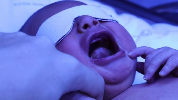Νεογνό Μωρό Κλαίει Κάτω Από Λάμπα Φωτοθεραπείας Θεραπεύεται Για Ίκτερο — Αρχείο Βίντεο