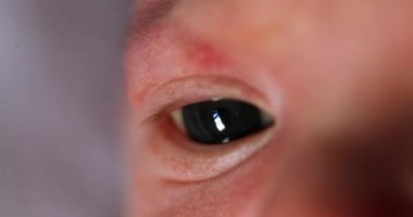 Newborn close-up macro of eyes