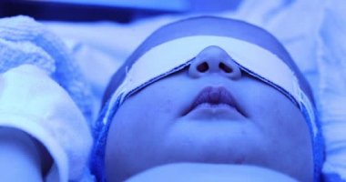 Newborn baby boy under phototherapy lamp. getting treated for jaundice