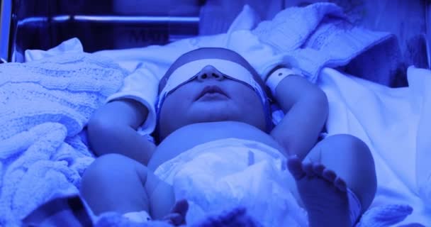Νεογέννητο Υπό Θεραπεία Φωτοθεραπείας Ίκτερος — Αρχείο Βίντεο