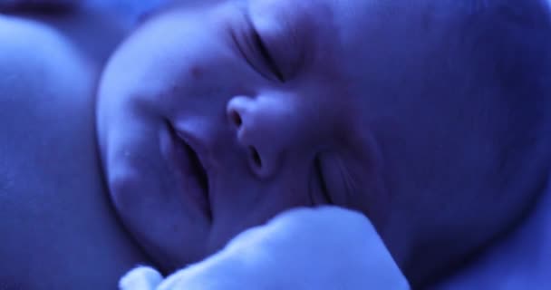 Новорожденный Мальчик Фотолампой Получить Лечение Желтухи — стоковое видео