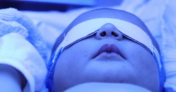 Newborn Baby Boy Phototherapy Lamp Getting Treated Jaundice — Stockvideo