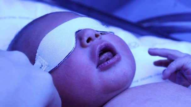 Новорожденный Ребенок Лампой Фототерапии Получает Лечение Желтухи — стоковое видео
