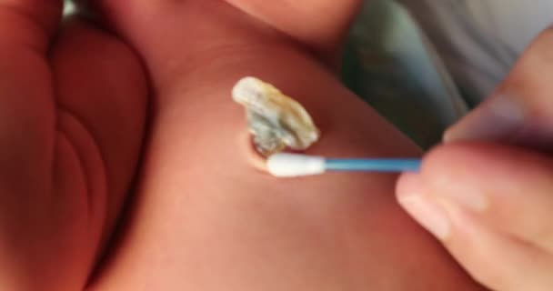 Cleaning Newborn Baby Umbilical Cord First Week Life — Vídeo de Stock