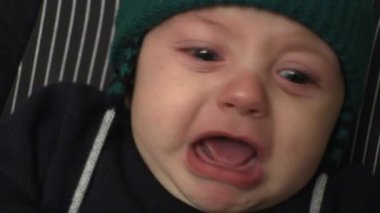 Upset sad infant baby face crying