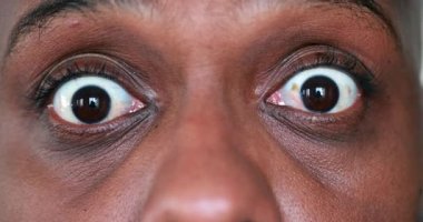 Fearful African man feeling paranoid and afraid, macro close-up eyes