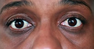 Afrikalı adam şok reaksiyonu. Makro kişi yüz ifadesi şaşırtıcıdır