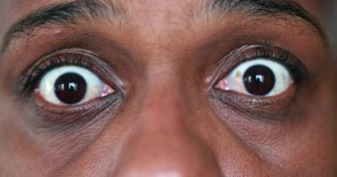 Shocking emotional reaction, close-up face portrait opening eyes in TERROR and HORROR