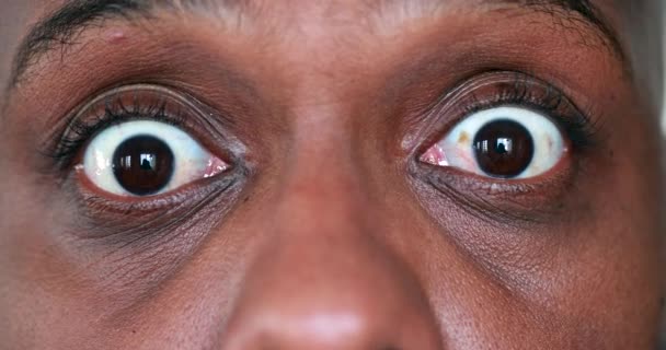 Fearful African Man Feeling Paranoid Afraid Macro Close Eyes — Stockvideo