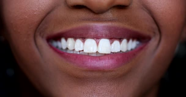 Black Girl Mouth Smiling Macro Close White Teeth African Ethnicity — Wideo stockowe