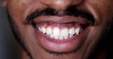 Afrika erkek yüzü, gülümseyen dudaklar.