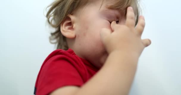 Tired Toddler Boy Rubbing Eye Hand Sleepy Baby Child — Video Stock