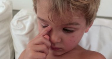 Child scratching eye, feeling tired. Handsome blond toddler boy face