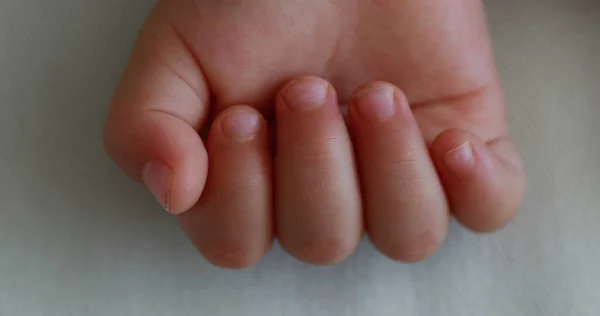 Baby Hand Macro Close Body Detail — 图库照片