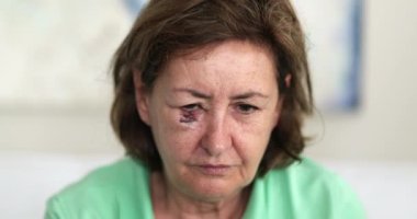 Yüzü morarmış bir kadın onaylamadığı için başını sallıyor.
