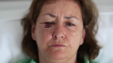Üzgün yaşlı kadın yaralı yüzüyle kameraya bakıyor.