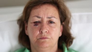 Kameraya bakarken yüzü morarmış yaşlı bir kadının portresi.