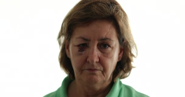 Frau Nach Operation Mit Verletzter Narbe Vor Kamera — Stockvideo