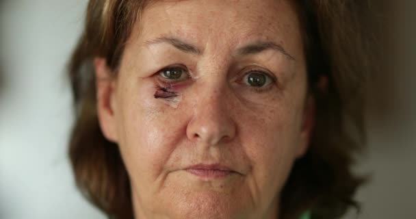 Ältere Frau Mit Geprelltem Vernarbtem Gesicht Blickt Traurig Die Kamera — Stockvideo
