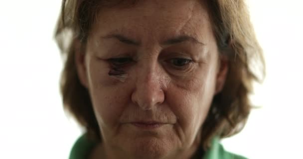 Donna Anziana Con Punti Sutura Guardando Giù Con Triste Emozione — Video Stock