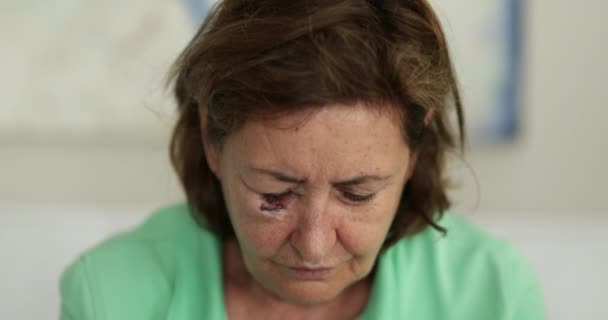 Yüzünde Morluk Morluk Olan Yaşlı Bir Kadın Aşağıya Bakıyor Üzgün — Stok video