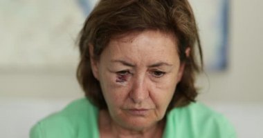 Yara izi olan yaşlı bir kadın üzgün bir şekilde kameraya bakıyor.