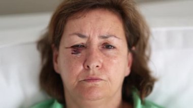 Yaralı, yaşlı bir kadının portresi. Gözlerini açıyor.