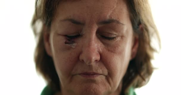 Porträt Einer Älteren Frau Mit Stichen Die Mit Traurigem Blick — Stockvideo