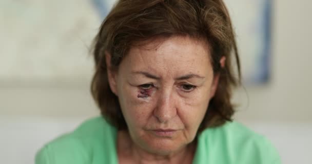 Mujer Mayor Magullada Con Cicatriz Mirando Cámara Con Emoción Triste — Vídeos de Stock